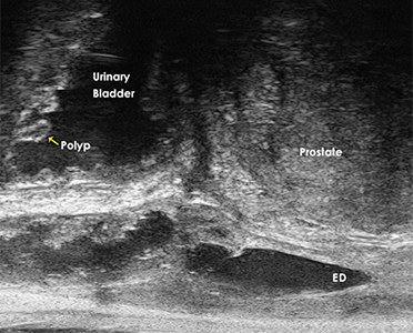 Micro-ultrasound image with labels marking the urinary bladder, prostate, ejaculatory duct and a small polyp