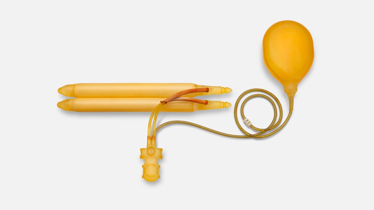 Illustrated top-down view of a three-piece inflatable penile prosthesis: paired cylinders, scrotal pump and abdominal fluid reservoir