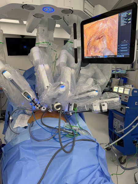 da Vinci multiport robotic system in theatre