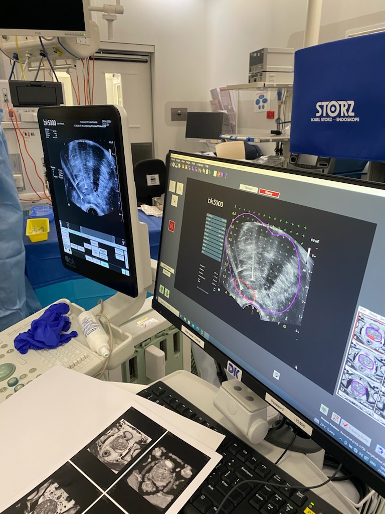 Advanced MRI and ultrasound fusion imaging equipment used at Urology NSW
